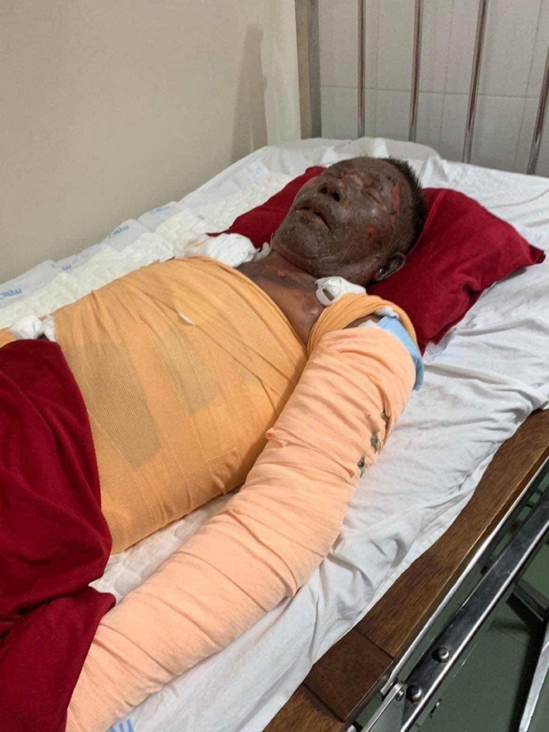 Chú Nguyễn Chi đang trong cơn nguy kịch cần sự giúp đỡ của các nhà hảo tâm!